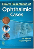 Clinical Presentation of Ophthalmic Cases | ABC Books
