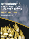 Orthodontic Treatment of Impacted Teeth, 3e**