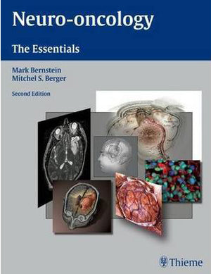 Neuro-oncology: The Essentials **