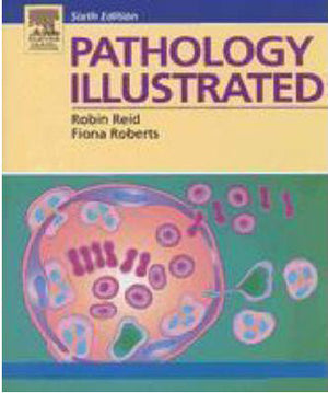Pathology Illustrated, 6th Edition **