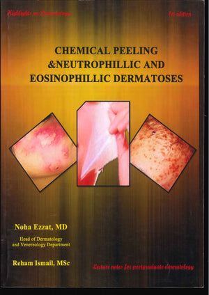Highlights on Dermatology : Chemical Peeling & Neutrophillic and Eosinophillic Dermatoses | ABC Books
