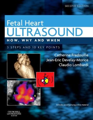 Fetal Heart Ultrasound, How, Why and When, 2e **