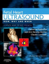 Fetal Heart Ultrasound, How, Why and When, 2e ** | ABC Books