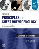 Felson's Principles of Chest Roentgenology, A Programmed Text , A Programmed Text , 5e | ABC Books
