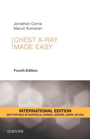 Chest X-Ray Made Easy IE, 4e | ABC Books