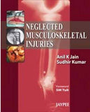 Neglected Musculoskeletal Injuries** | ABC Books