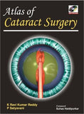 Atlas of Cataract Surgery | ABC Books