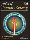 Atlas of Cataract Surgery | ABC Books