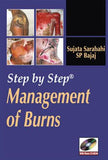 Step By Step Management of Burns