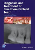 Diagnosis and Treatment of Furcation-Involved Teeth | ABC Books