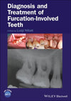 Diagnosis and Treatment of Furcation-Involved Teeth | ABC Books