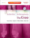 Arthritis and Arthroplasty: The Knee: Expert Consult: Online, Print and DVD **