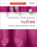Arthritis and Arthroplasty: The Knee: Expert Consult: Online, Print and DVD ** | ABC Books