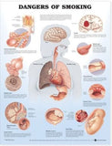 Dangers of Smoking Anatomical Chart | ABC Books