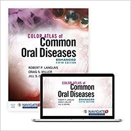 Color Atlas of Common Oral Diseases, Enhanced Edition 5e