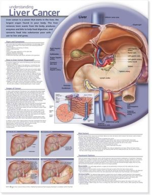 Understanding Liver Cancer Chart - ABC Books
