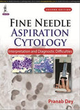Fine Needle Aspiration Cytology: Interpretation and Diagnostic Difficulties 2e