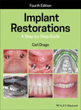 Implant Restorations - A Step-by-Step Guide 4e | ABC Books