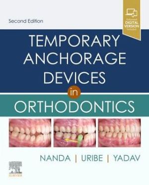 Temporary Anchorage Devices in Orthodontics , 2nd Edition