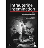 Intrauterine Insemination 3E