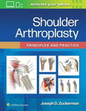 Shoulder Arthroplasty : Principles and Practice | ABC Books