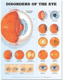 Disorders of the Eye Anatomical Chart, 2e