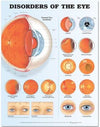 Disorders of the Eye Anatomical Chart, 2e | ABC Books