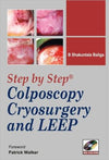 Step-By-Step Colposcopy, Cryosurgery and Leep **