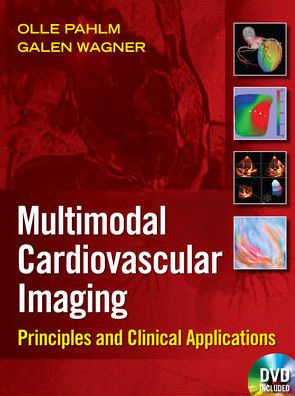 Cardiovascular Multimodal Image-Guided Diagnosis And Therapy