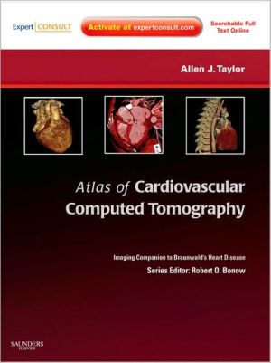 Atlas of Cardiovascular Computed Tomography **