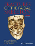 Fractures of the Facial Skeleton 2e