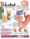 Dangers of Alcohol Anatomical Chart, 2e | ABC Books