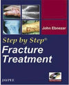 Step by Step Fracture Treatment with Photo CD-ROM** | ABC Books
