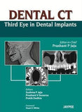Dental CT: Third Eye in Dental Implants | ABC Books
