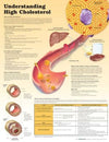 Understanding High Cholesterol Chart | ABC Books
