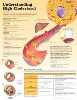 Understanding High Cholesterol Chart | ABC Books