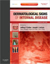 Dermatological Signs of Internal Disease, 4e **