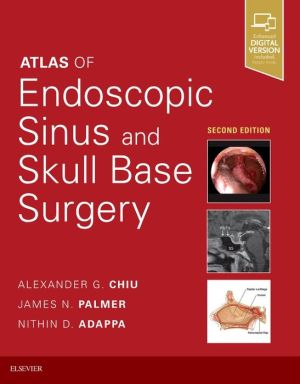 Atlas of Endoscopic Sinus and Skull Base Surgery, 2nd Edition