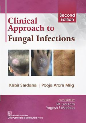 Clinical Approach to Fungal Infections, 2e (HB)