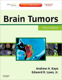 Brain Tumors, 3e ** | ABC Books