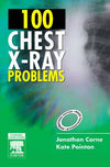 100 Chest X-Ray Problems IE **