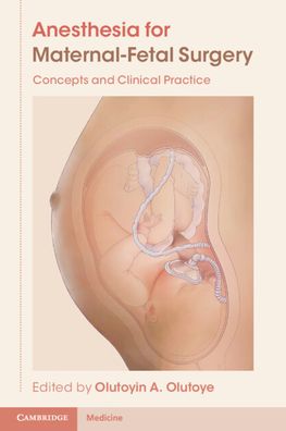 Anesthesia for Maternal-Fetal Surgery : Concepts and Clinical Practice | ABC Books