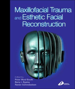 Maxillofacial Trauma and Esthetic Reconstruction **