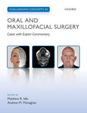 Challenging Concepts in Oral and Maxillofacial Surgery : Cases with Expert Commentary | ABC Books