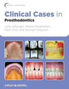 Clinical Cases in Prosthodontics | ABC Books