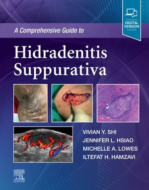 A Comprehensive Guide to Hidradenitis Suppurativa | ABC Books
