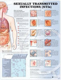Sexually Transmitted Infections Anatomical Chart | ABC Books
