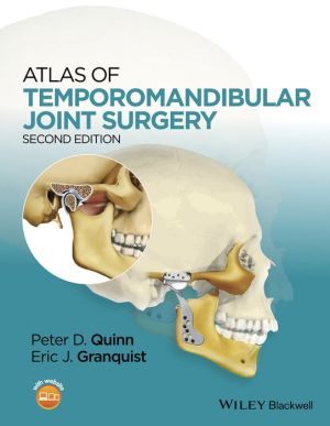 Atlas of Temporomandibular Joint Surgery, 2e | ABC Books