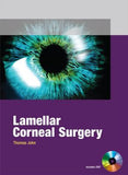 Lamellar Corneal Surgery