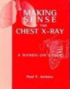 Making Sense of the Chest X-ray : A hands-on guide**